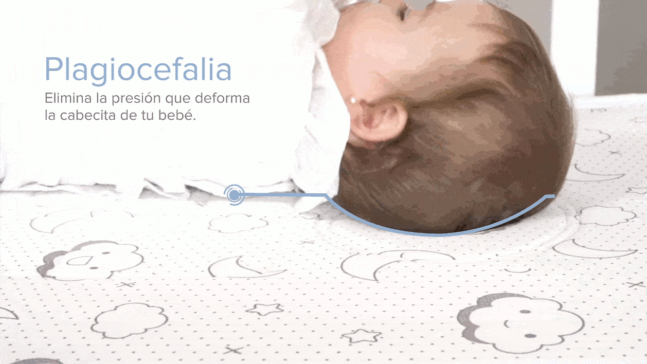 Babykeeper previene plagiocefalia