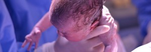 Las células madre del cordón umbilical se extraen después del parto