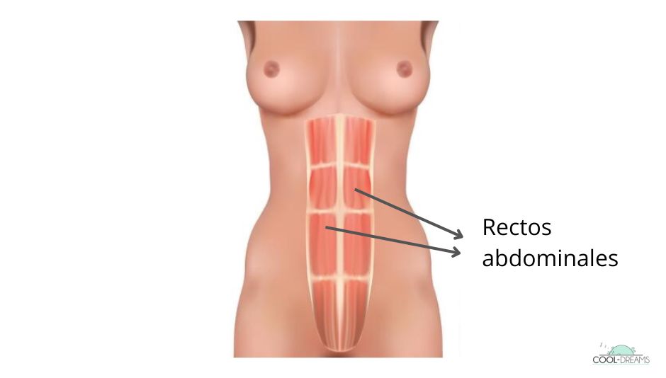 Rectos abdominales sin diástasis por embarazo