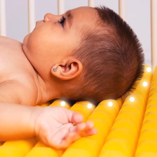 como evitar plagiocefalia cabeza plana finn